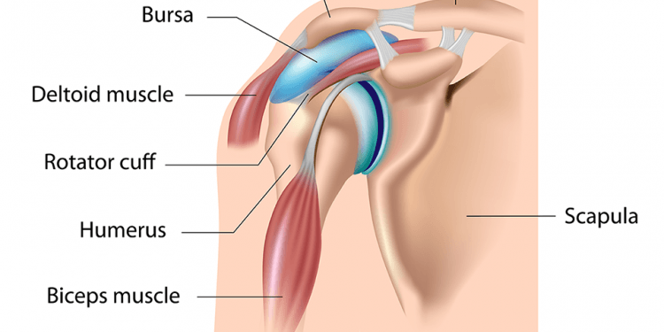 Bursitis – a Secondary Diagnosis & Treatment