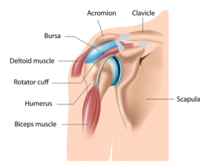  Bursitis a Secondary Diagnosis  Treatment at CardioFlex Therapy 