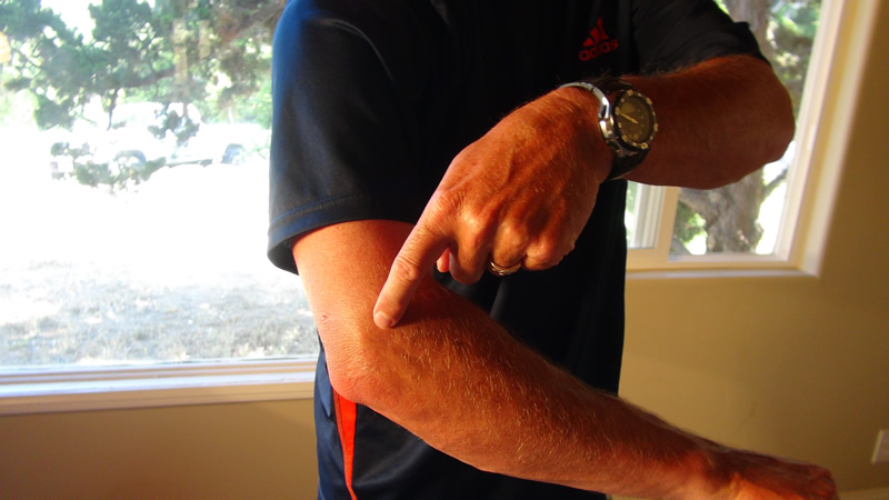 Elbow Pain Injury and Treatment offered at CardioFlex Therapy