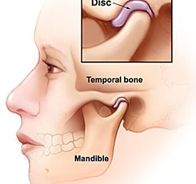 All About TMJ